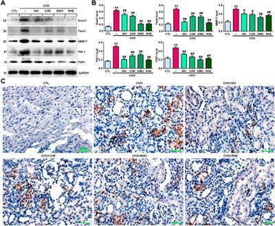 Shenkang injection improves chronic kidney disease by inhibiting multiple renin-angiotensin system genes by blocking the Wnt/β-catenin signalling pathway